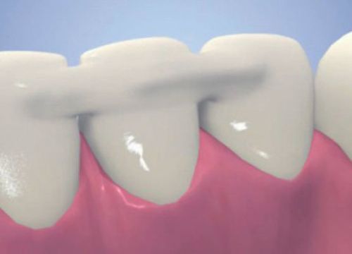 +74957832323 звонок из Новастом