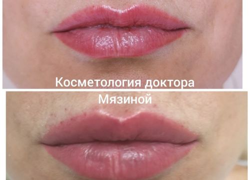 +79035461580 звонок из Косметология доктора Мязиной