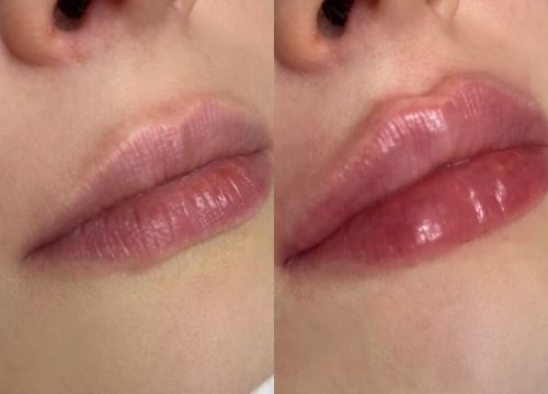 +79209090437 звонок из Клеопатра косметология