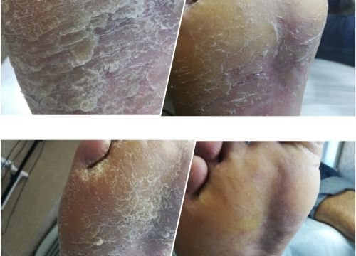 +79272722383 звонок из Кабинет здоровой стопы