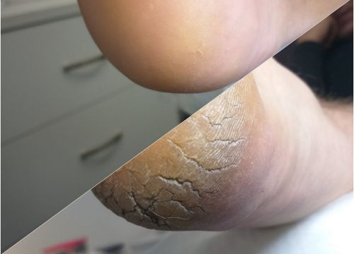 +79272722383 звонок из Кабинет здоровой стопы