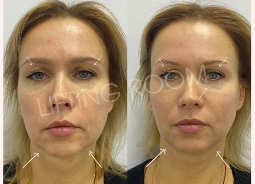 +79869512581 звонок из Лифтинг Рум