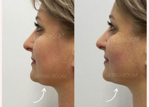 +79869512581 звонок из Лифтинг Рум