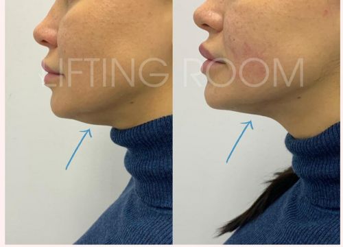 +79869512581 звонок из Лифтинг Рум